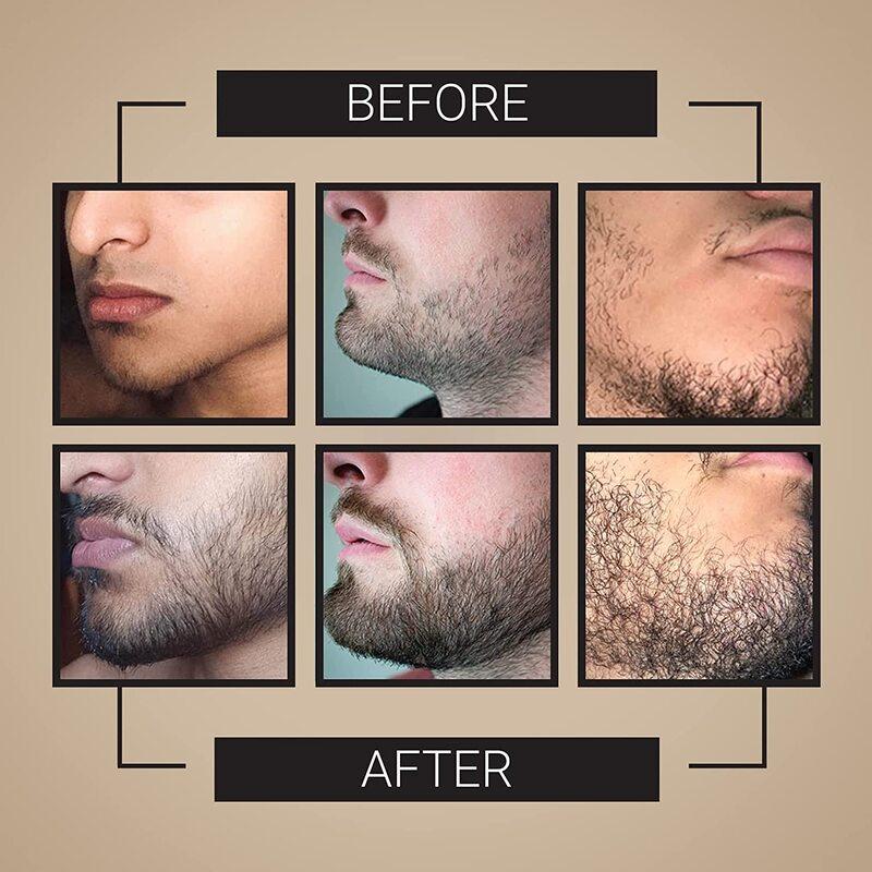 ​​the-beard-club-reviews-before-and-after